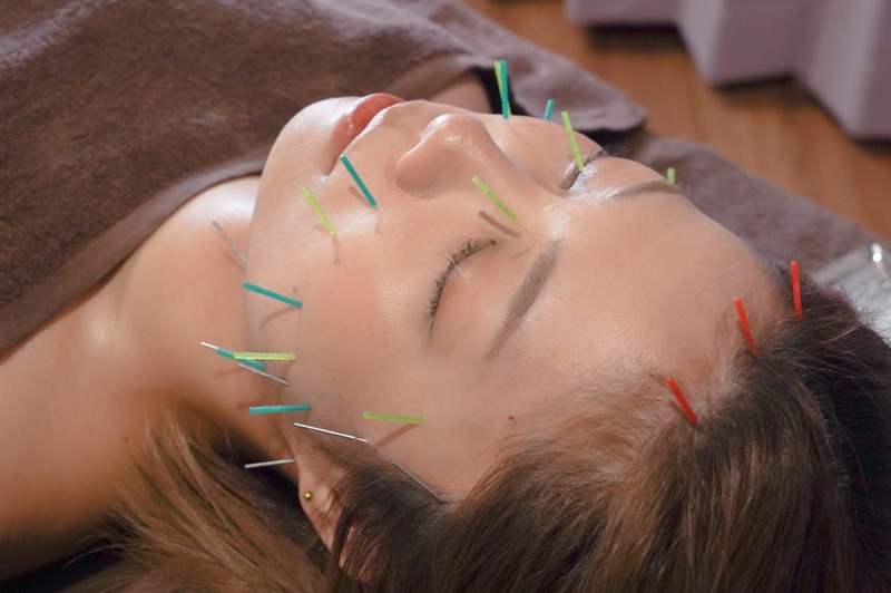 kasumi鍼灸院の強み